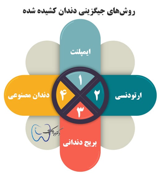 روش های جایگزینی دندان کشیده شده