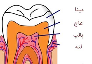 ترمیم دندان بر اساس محل پوسیدگی