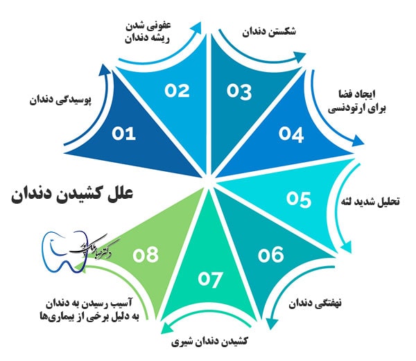 علل کشیدن دندان (اینفوگرافیک)