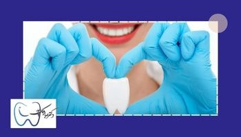 نوع دندان در هزینه عصب کشی دندان
