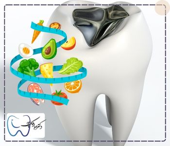 رژیم غذایی بعد از پر کردن دندان