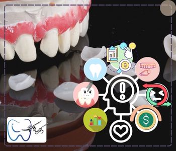 عوامل موثر در هزینه روکش دندان