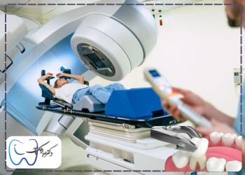 Prohibition-of-tooth-extraction-after-radiotherapy ممنوعیت کشیدن دندان بعد از رادیوتراپی