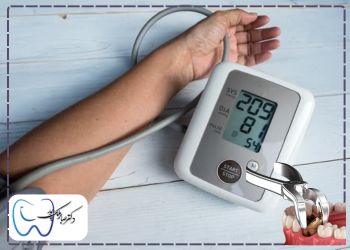 Prohibition-of-tooth-extraction-at-high-blood-pressure ممنوعیت کشیدن دندان در فشار خون بالا