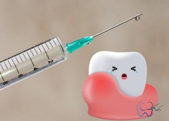 Candida-Ampoule-for-Tooth-Infection کاندیدا آمپول برای عفونت دندان